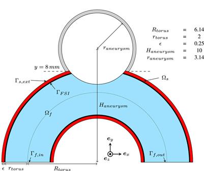 AnXplore: a comprehensive fluid-structure interaction study of 101 intracranial aneurysms